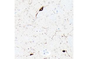 Immunohistochemistry of paraffin-embedded rat brain using Somatostatin (SST) Rabbit mAb (ABIN7270492) at dilution of 1:1000 (40x lens). (Somatostatin 抗体  (AA 23-116))