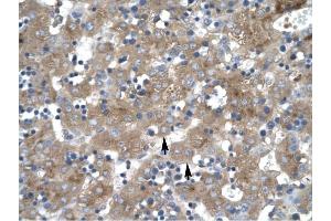 ZNF81 antibody was used for immunohistochemistry at a concentration of 4-8 ug/ml to stain Hepatocyte (arrows) in Human liver. (ZNF81 抗体  (Middle Region))