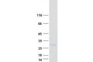 Western Blotting (WB) image for Peptidoglycan Recognition Protein 1 (PGLYRP1) protein (Myc-DYKDDDDK Tag) (ABIN2728786)