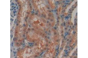 IHC-P analysis of Rat Tissue, with DAB staining. (Androgen Receptor 抗体  (AA 491-679))