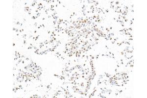 Immunocytochemistry (ICC) image for anti-Runt-Related Transcription Factor 2 (RUNX2) (AA 300-350) antibody (ABIN7795797) (Recombinant RUNX2 抗体  (AA 300-350))