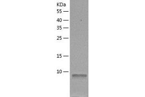 ERH Protein (AA 1-104) (His tag)