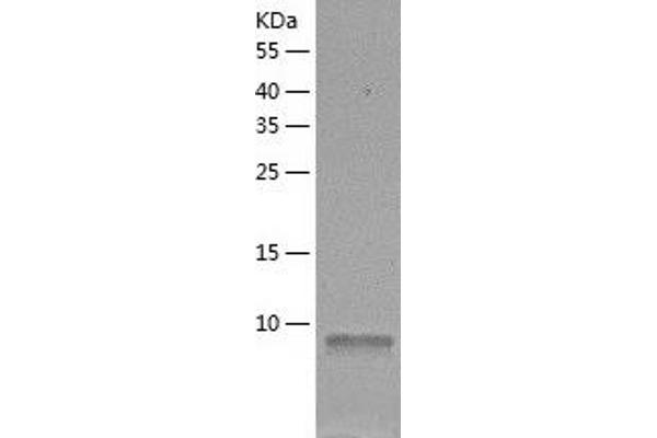 ERH Protein (AA 1-104) (His tag)