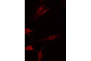 ABIN6275280 staining Hela by IF/ICC. (MT-ND1 抗体  (Internal Region))