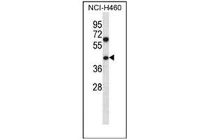 Western blot analysis of PUS1 Antibody (C-term) in NCI-H460 cell line lysates (35ug/lane). (PUS1 抗体  (C-Term))