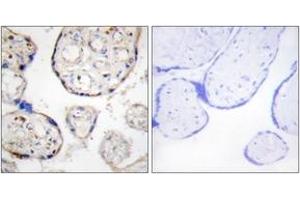 Immunohistochemistry analysis of paraffin-embedded human placenta tissue, using STEAP4 Antibody. (STEAP4 抗体  (AA 201-250))