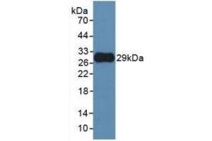 Detection of Recombinant MMP25, Human using Monoclonal Antibody to Matrix Metalloproteinase 25 (MMP25) (MMP25 抗体  (AA 108-313))