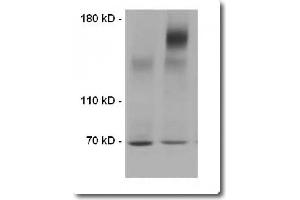 Western Blotting (WB) image for Transmembrane Protein Extraction Reagent (ABIN1059100)