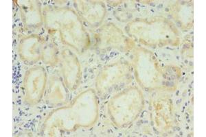 Immunohistochemistry of paraffin-embedded human kidney tissue using ABIN7158756 at dilution of 1:100 (LYPLAL1 抗体  (AA 2-237))
