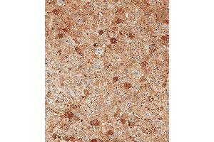 Immunohistochemistry (Paraffin-embedded Sections) (IHC (p)) image for anti-Albumin (ALB) (AA 540-569), (C-Term) antibody (ABIN390450)