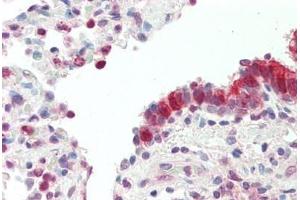 Human, Lung: Foramlin-Fixed Paraffin-Embedded  (FFPE) (MXD4 抗体  (N-Term))