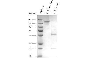 Expression of recombinant CR3022 antibody (SARS-CoV-2 抗体)