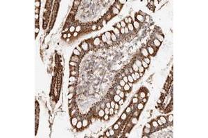 Immunohistochemical staining of human small intestine with ARHGEF10L polyclonal antibody  strong cytoplasmic positivity in glandular cells. (ARHGEF10L 抗体)