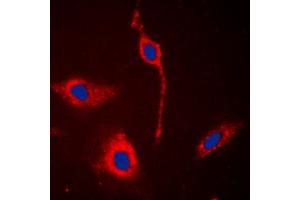 Immunofluorescent analysis of EPHA6 staining in A549 cells. (EPH Receptor A6 抗体  (C-Term))
