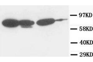 Western Blotting (WB) image for anti-Junction Plakoglobin (JUP) antibody (ABIN1107897) (JUP 抗体)