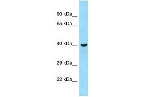 WB Suggested Anti-Qtrtd1 Antibody Titration: 1. (QTRTD1 抗体  (C-Term))
