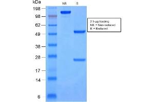 SDS-PAGE Analysis Purified Cytokeratin 8/18 Mouse Monoclonal Antibody (rKRT8. (Recombinant KRT8, KRT18 抗体)