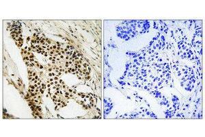 Immunohistochemistry (IHC) image for anti-Mitogen-Activated Protein Kinase-Activated Protein Kinase 2 (MAPKAPK2) (Ser272) antibody (ABIN1848344) (MAPKAP Kinase 2 抗体  (Ser272))
