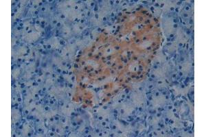 DAB staining on IHC-P; Samples: Mouse Pancreas Tissue (PAI1 抗体  (AA 141-389))