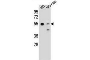 Western blot analysis of GNAS Antibody (C-term) in 293, NCI-H292 cell line lysates (35ug/lane).