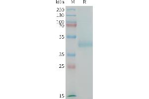 Human (567-667) Protein, hFc Tag on SDS-PAGE under reducing condition.