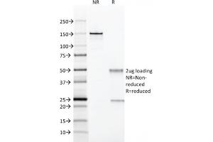 SDS-PAGE Analysis Purified CD28 Mouse Monoclonal Antibody (204. (CD28 抗体)