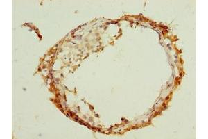 Immunohistochemistry of paraffin-embedded human testis tissue using ABIN7144623 at dilution of 1:100 (ARMCX2 抗体  (AA 161-460))