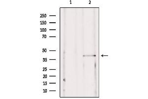 Western blot analysis of extracts from mouse brain, using SSTR2  Antibody.
