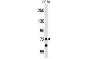 PRDM8 Antibody (N-term) western blot analysis in CEM cell line lysates (35µg/lane). (PRDM8 抗体  (N-Term))