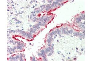 Human, Lung: Formalin-Fixed Paraffin-Embedded (FFPE). (ALDH3B1 抗体  (N-Term))