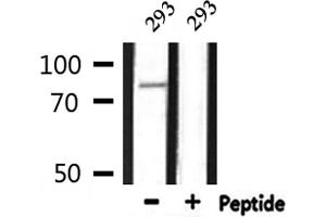 Western blot analysis of extracts from 293, using CDH3 Antibody. (P-Cadherin 抗体  (N-Term))