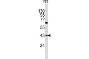 Western blot analysis of PRELP antibody (C-term) in Y79 cell line lysates (35ug/lane). (PRELP 抗体  (C-Term))