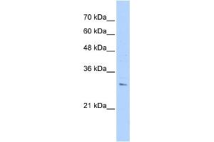 WB Suggested Anti-RHBDL2 Antibody Titration:  0. (RHBDL2 抗体  (N-Term))