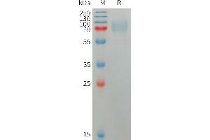 SDS-PAGE (SDS) image for Plexin Domain Containing 2 (PLXDC2) (AA 31-453) protein (His tag) (ABIN7491361)