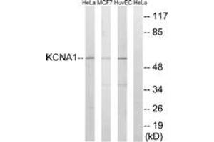 Western blot analysis of extracts from HuvEc/MCF-7/HeLa cells, using KCNA1 Antibody. (KCNA1 抗体  (AA 256-305))