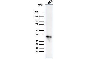 Western Blot Analysis of Raji cell lysate using CD74 Mouse Monoclonal Antibody (CLIP/813) (CD74 抗体)