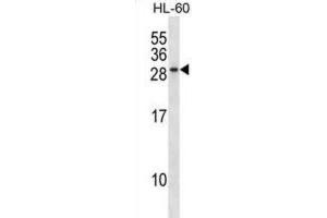 Western Blotting (WB) image for anti-RAB15, Member RAS Onocogene Family (RAB15) antibody (ABIN2998980) (RAB15 抗体)
