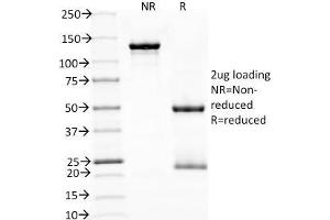 SDS-PAGE Analysis Purified PD1 (CD279) Monoclonal Antibody (NAT105). (PD-1 抗体)