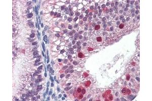 IHC testing of FFPE human uterus tissue with FANCG antibody at 3ug/ml. (FANCG 抗体)