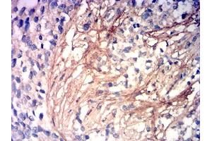 Immunohistochemistry (IHC) image for anti-Collagen, Type III, alpha 1 (COL3A1) (AA 24-153) antibody (ABIN7193483)