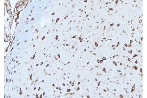 ABIN6277528 at 1/100 staining Mouse brain tissue by IHC-P. (Ephrin A1 抗体  (Internal Region))