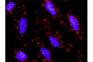 Proximity Ligation Analysis of protein-protein interactions between ETS1 and MAPK1. (ETS1 抗体  (AA 1-441))