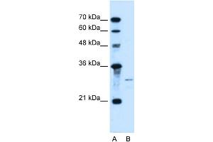 WB Suggested Anti-SHH Antibody Titration:  0. (Sonic Hedgehog 抗体  (N-Term))