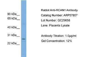 WB Suggested Anti-RCAN1  Antibody Titration: 0. (RCAN1 抗体  (N-Term))