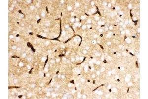 IHC testing of FFPE mouse brain with SLC2A1 antibody. (GLUT1 抗体  (AA 92-492))