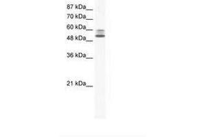 Image no. 1 for anti-Lysine (K)-Specific Demethylase 4D (KDM4D) (AA 434-483) antibody (ABIN202713) (JMJD2D 抗体  (AA 434-483))