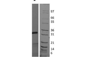 SDS-PAGE of Human Interleukin-17E (IL-25) Recombinant Protein SDS-PAGE of Human Interleukin-17E (IL-25) Recombinant Protein. (IL-25 蛋白)