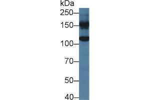 Western blot analysis of Mouse Liver lysate, using Human GLDC Antibody (2 µg/ml) and HRP-conjugated Goat Anti-Rabbit antibody ( (GLDC 抗体  (AA 81-268))