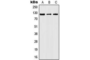 Western blot analysis of JAK2 (pY1007) expression in HeLa (A), TF1 (B), NIH3T3 (C), rat kidney (D) whole cell lysates. (JAK2 抗体  (C-Term, pTyr1007))