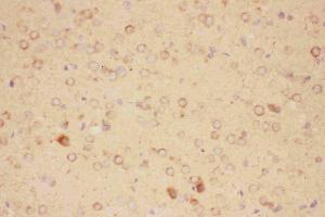 Immunohistochemistry (IHC) image for anti-Ciliary Neurotrophic Factor (CNTF) (AA 2-200) antibody (ABIN3043814)